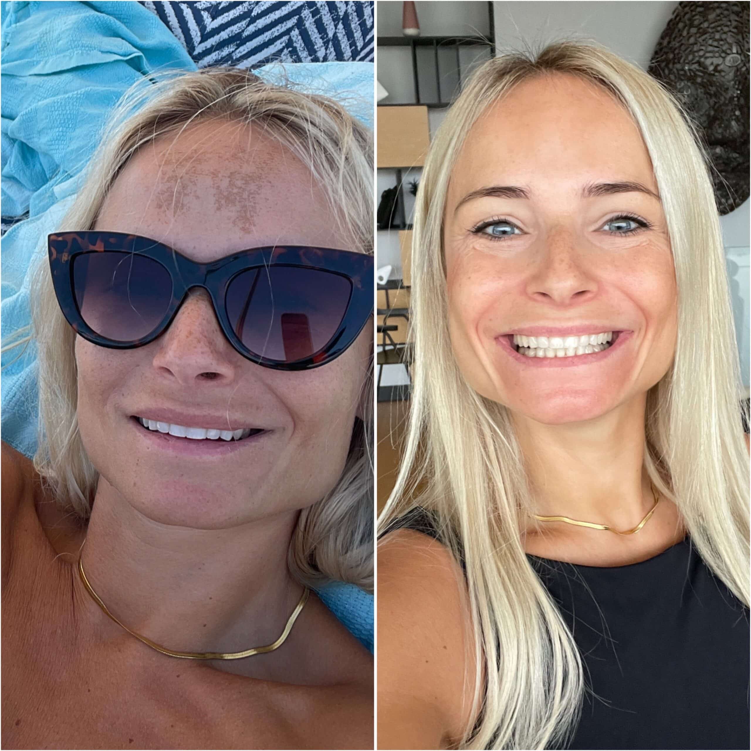 Billede af produktmulighed